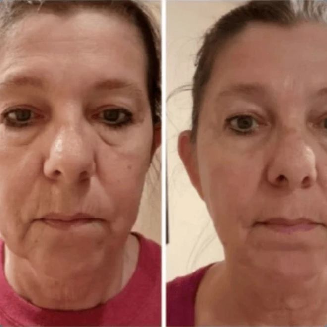 Éternité Spa client before and after a course of treatments